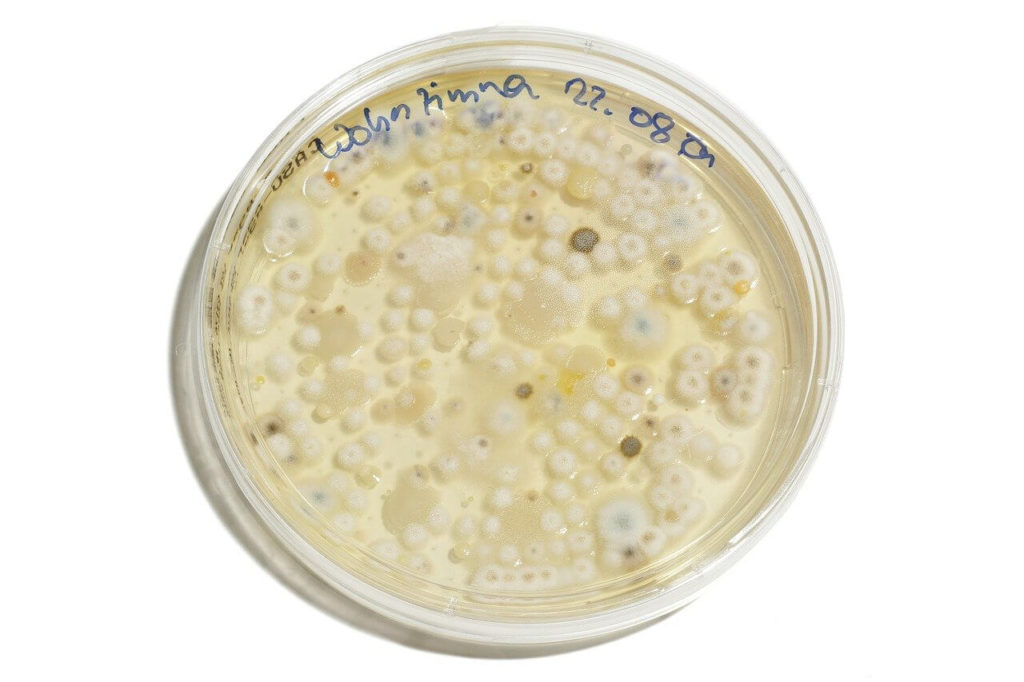 Boîte de Petri couverte de moisissures et bactéries illustrant la découverte et la fabrication de la pénicilline.